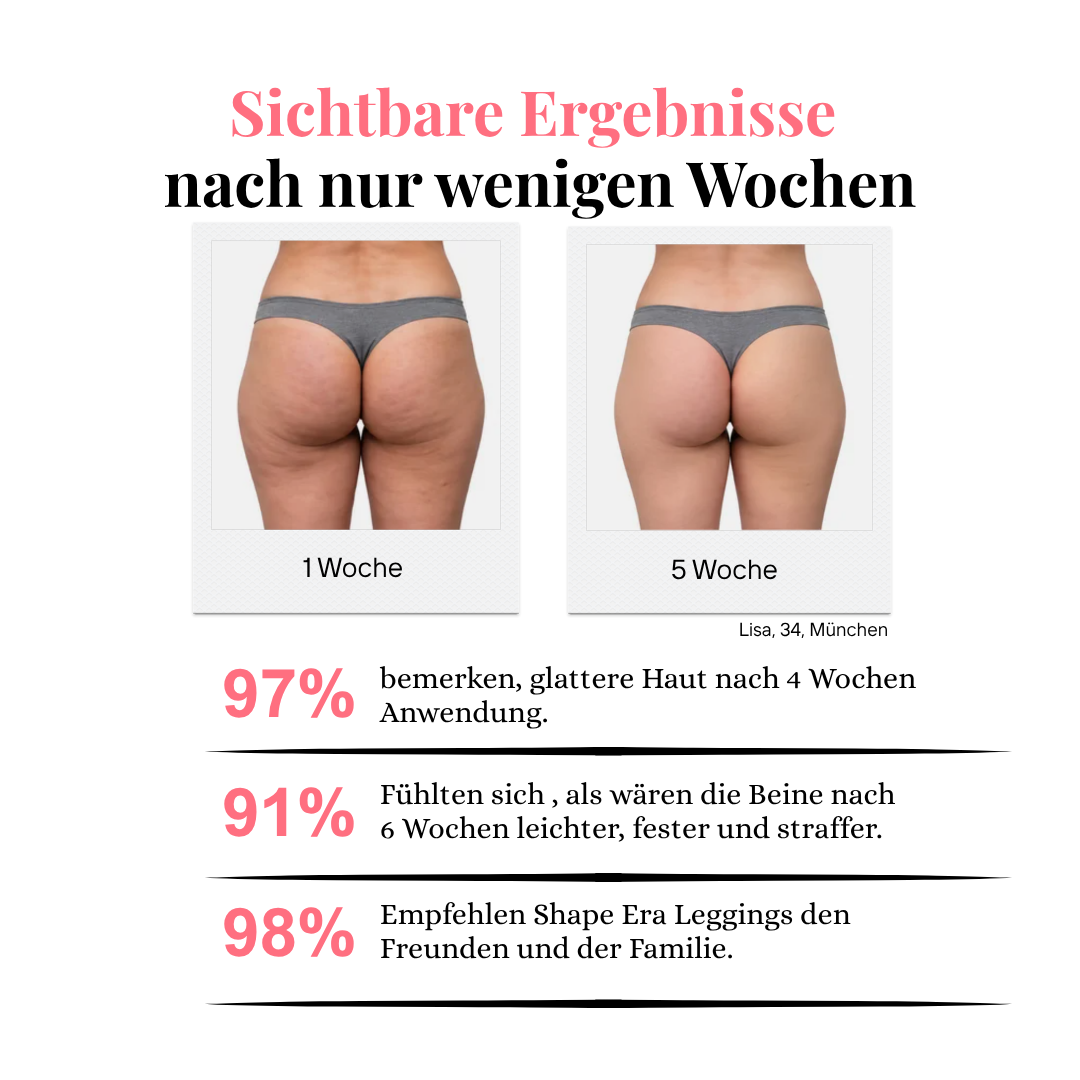 3D Anti Cellulite Kompressionsleggings